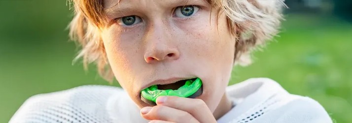 Dentist-South-Gate-CA-Mouth-Guards.jpg